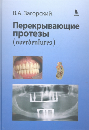2313512_detail