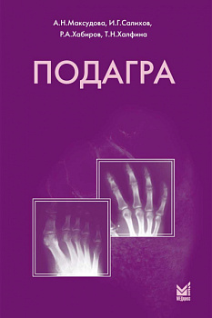 Подагра