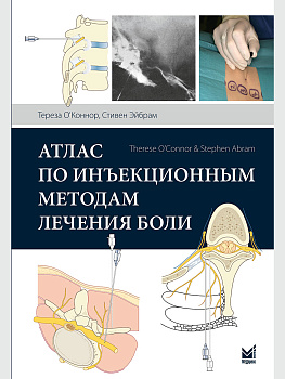 Атлас по инъекционным методам лечения боли.