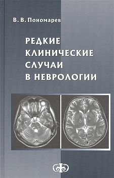 Редкие клинические случаи в неврологии