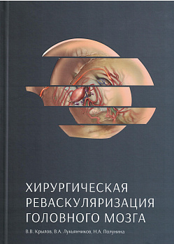 Хирургическая реваскуляризация головного мозга.