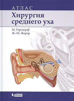 Хирургия среднего уха: атлас