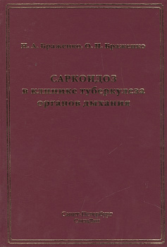 Саркоидоз в клинике туберкулеза органов дыхания