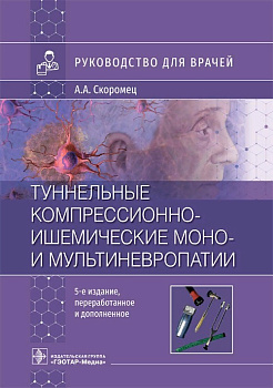 Туннельное компрессионно-ишемические моно- и мультиневропатии