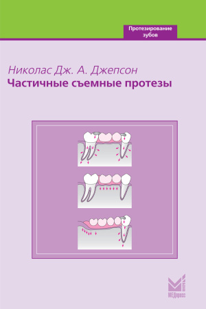 032_Chastichnye_szemnye_protezyuDzhepsonp.jpg