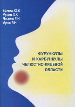 Фурункулы и карбункулы челюстно-лицевой области