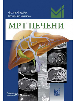 МРТ печени