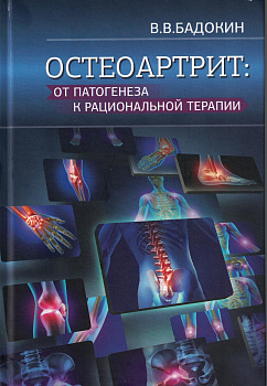 Остеоартрит: от патогенеза к рациональной терапии