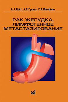 Рак желудка. Лимфогенное метастазирование