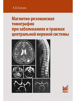 Магнитно-резонансная томография при заболеваниях и травмах центральной нервной системы
