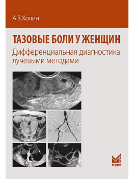 Тазовые боли у женщин