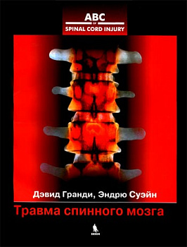 Травма спинного мозга