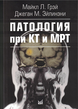 Патология при КТ и МРТ