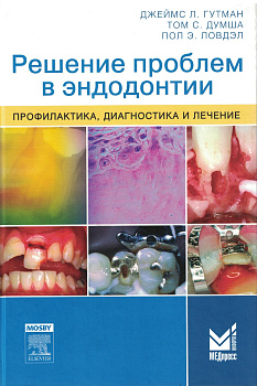 Решение проблем в эндодонтии.