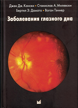 Заболевания глазного дна