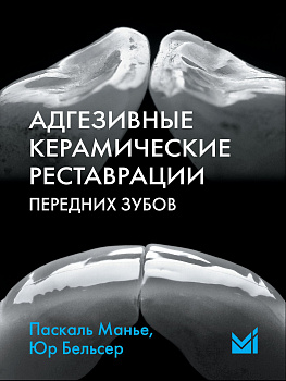 Адгезивные керамические реставрации передних зубов