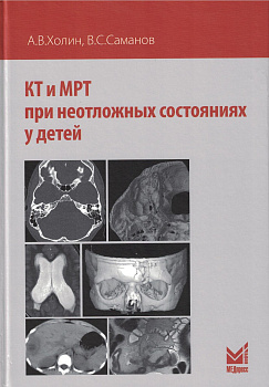 КТ и МРТ при неотложных состояниях у детей