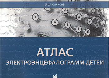 Атлас электроэнцефалограмм детей