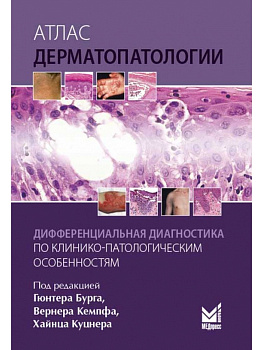 Атлас дерматопатологии