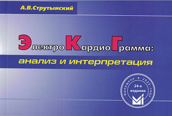 Электрокардиограмма: анализ и интерпретация