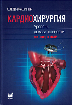 Кардиохирургия. Уровень доказательности экспертный