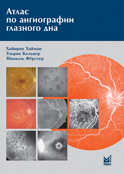 Атлас по ангиографии глазного дна