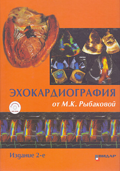 Эхокардиография от М.К. Рыбаковой
