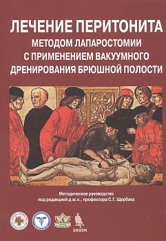 Лечение перитонита методом лапаростомии с применением вакуумного дренирования брюшной полости