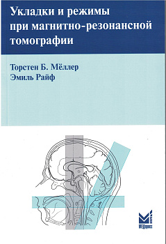 Укладки и режимы при магнитно-резонансной томографии