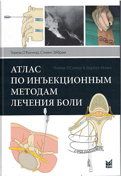 Атлас по инъекционным методам лечения боли.