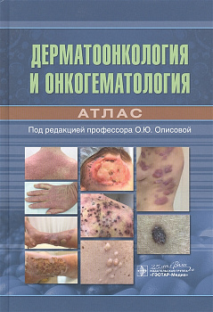 Дерматоонкология и онкогематология. Атлас