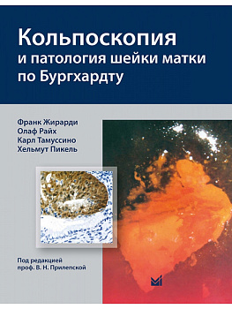 Кольпоскопия и патология шейки матки по Бургхардту