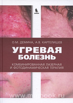 Угревая болезнь. Комбинированная лазерная и фотодинамическая терапия