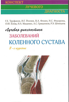 Лучевая диагностика заболеваний коленного сустава