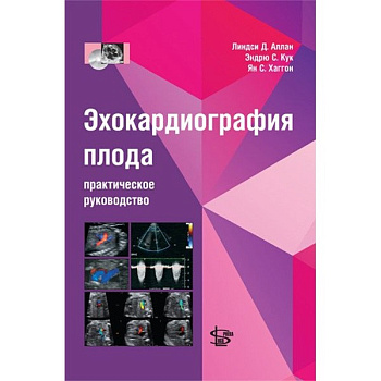 Эхокардиография плода