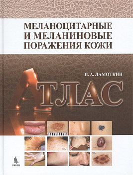 Меланоцитарные и меланиновые поражения кожи. Атлас