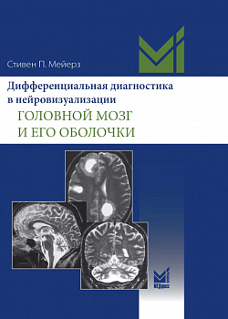 Дифференциальная диагностика в нейровизуализации. Головной мозг и его оболочки.
