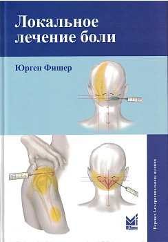 Локальное лечение боли