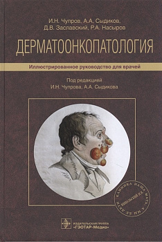 Дерматоонкопатология