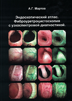 Эндоскопический атлас. Фиброуретроцистоскопия с узкоспектровой диагностикой