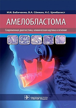 Амелобластома: современная диагностика, клиническая картина и лечение